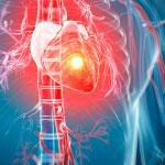 tanda-tanda penyakit jantung akibat operasi bypass jantung
