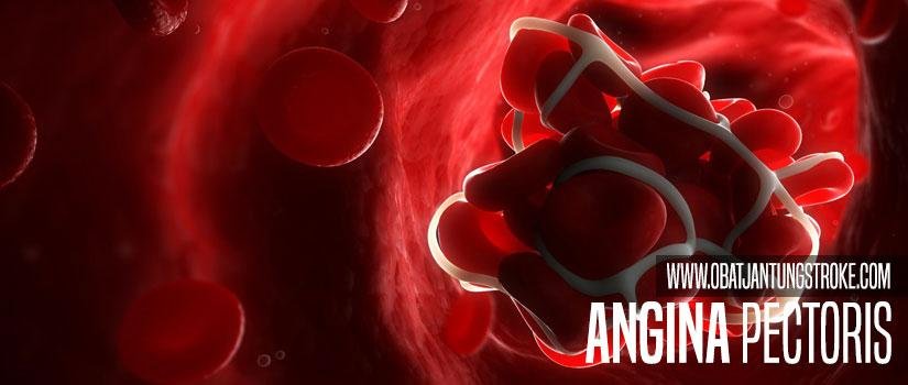 Angina Pectoris